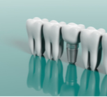 השתלה ממוחשבת: יותר מהיר, פחות כואב-תמונה